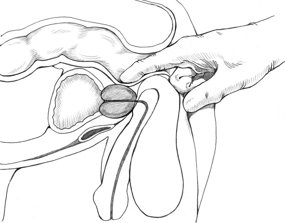 Il massaggio prostatico è incluso nel complesso dei metodi di trattamento della prostatite